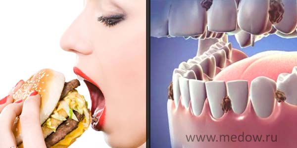 Остатки пищи между зубов после еды